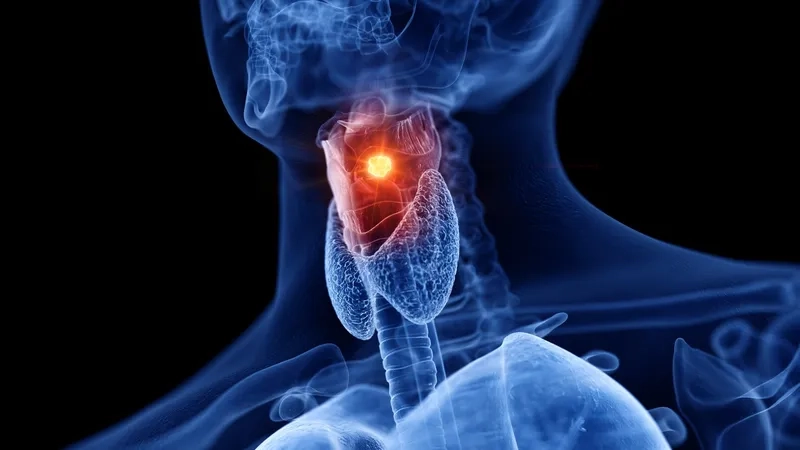 Learning what is laryngeal cancer and its risks