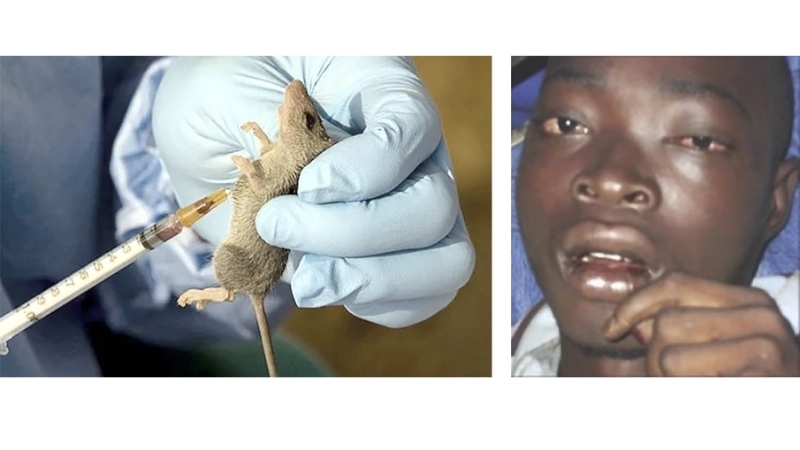 Learn key Lassa fever prevention steps now