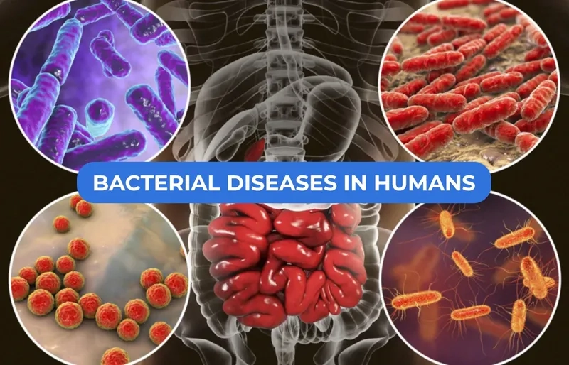 How is Legionellosis transmitted diagram
