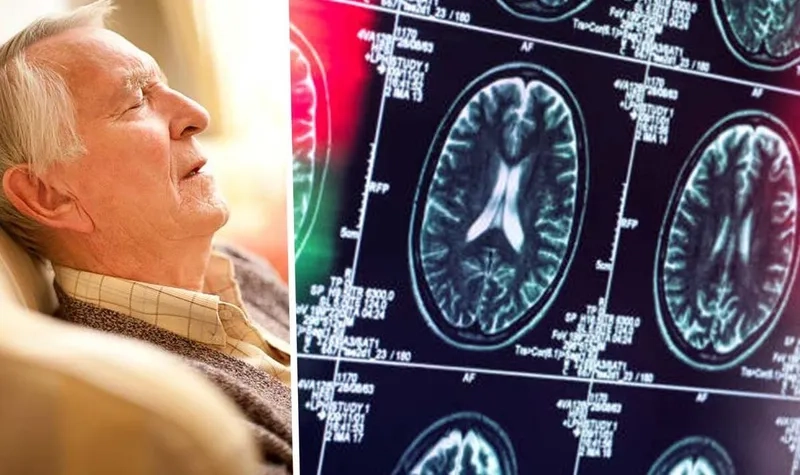 Caregiver support for Lewy Body Dementia patients