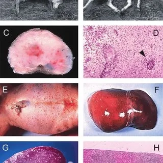 High-risk foods that can cause listeria