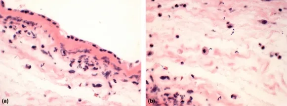 Medical options for treatment for listeriosis