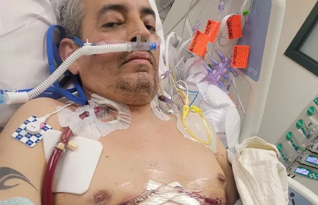 Comparing the different types of lung cancer