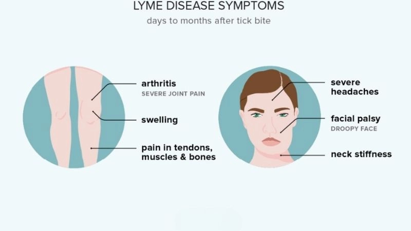 Lyme carditis and fainting warning signal of rhythm problems