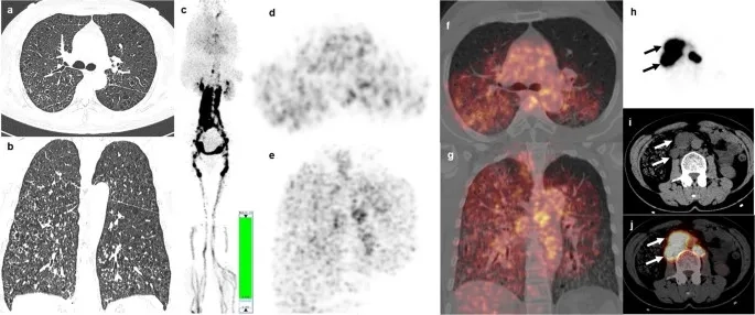 Shortness of breath in women illustration