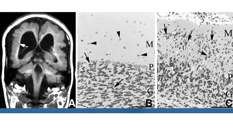 Stay safe from rodent-borne virus exposure at home