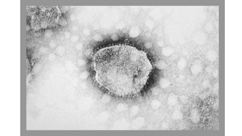 Discover arenavirus types including LCMV affecting humans