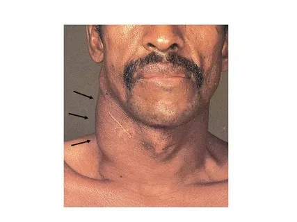 Microscopic image of Chlamydia trachomatis