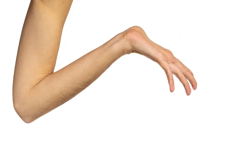 The molecular structure of the fibrillin-1 gene