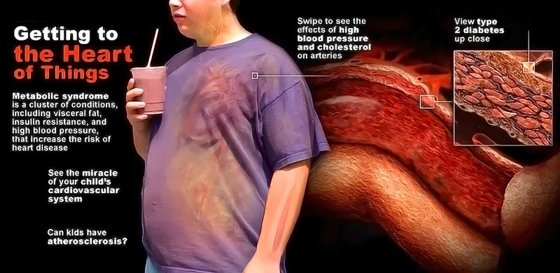 Metabolic syndrome criteria listed in diagnostic chart