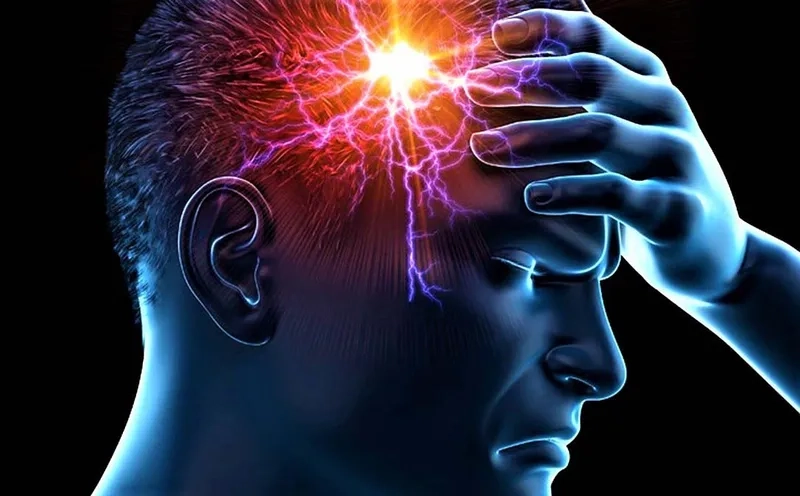 An infographic of common migraine symptoms