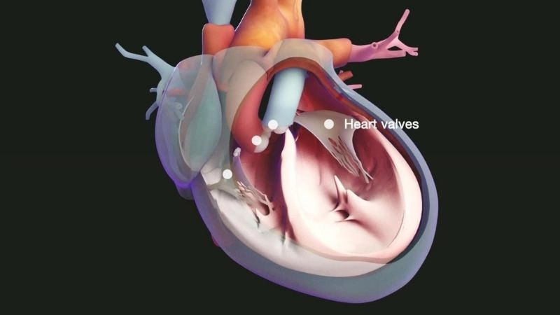 Mitral Valve Prolapse And Pregnancy require monitoring