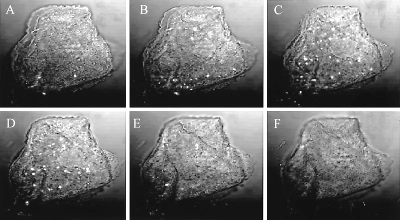 Understanding Why Mgen is an STD