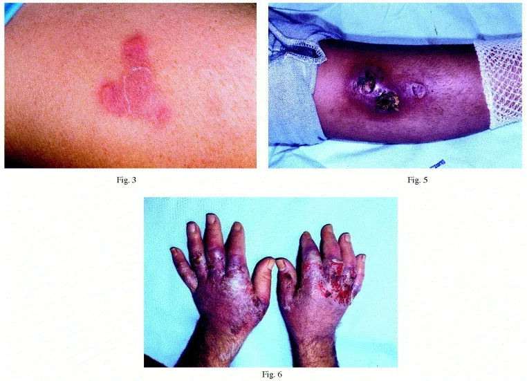 MDS prognosis data presented in clinical research chart