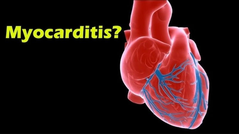 Myocarditis symptoms warning signs of heart muscle inflammation