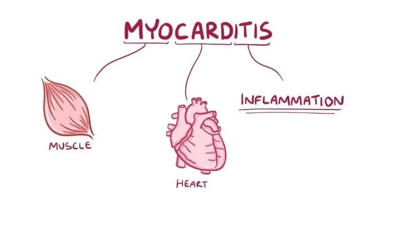 Myocarditis treatment medical therapies to manage inflammation