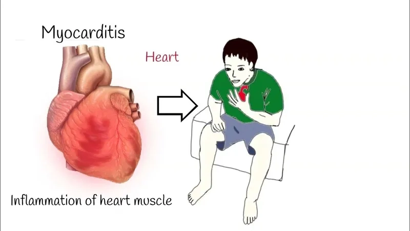 Understanding the myocarditis long term effects on health