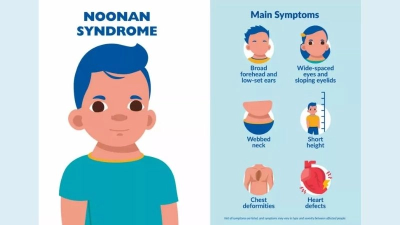 Noonan syndrome causes and risk factors