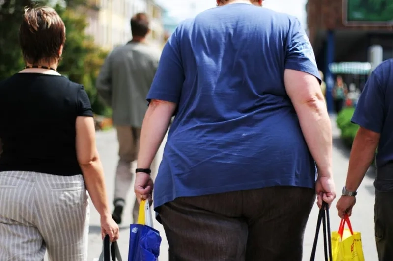 Morbid obesity and related health conditions