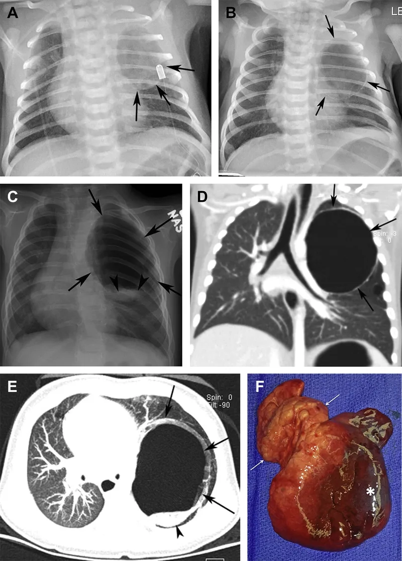 Promoting workplace safety for lung health protection