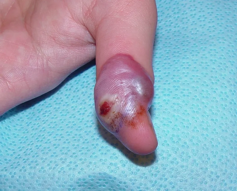 Orf virus: a common sheep and goat disease