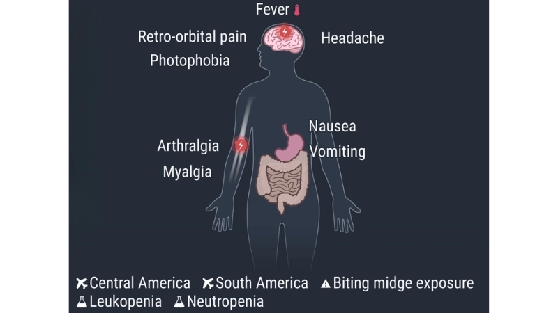 Oropouche Fever care with Oropouche fever treatment