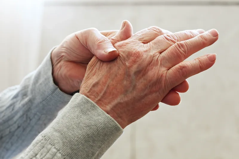 A person experiencing symptoms of arthritis in the knee