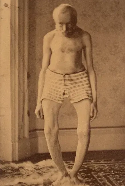 A guide to Paget's disease treatment options