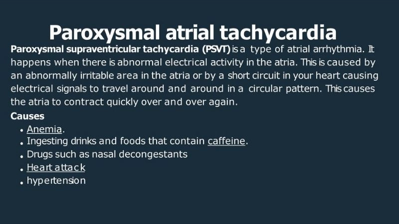 Paroxysmal Supraventricular Tachycardia diagnosis relies on ECG and monitoring