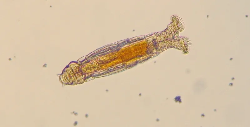 X-ray showing septic arthritis from pasteurella