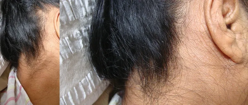 Children playing, asking the question is head lice contagious