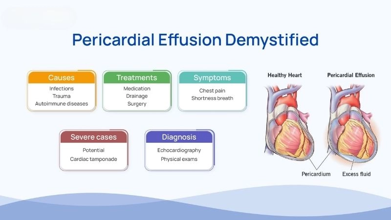 Pericardial effusion and cancer link between tumors and fluid buildup