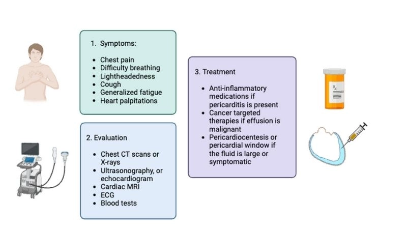 Acute pericarditis sudden inflammation affecting heart health