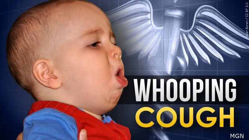 Recognizing key pertussis symptoms in children