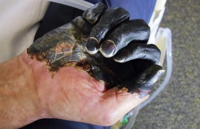 Scientist developing a new bubonic plague vaccine