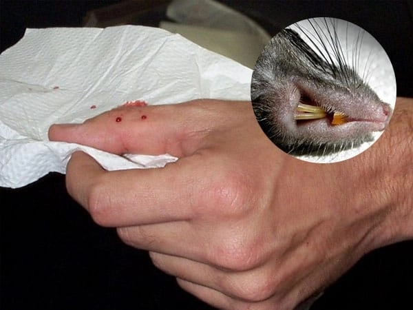 A medical drawing of typical bubonic plague sores (buboes)