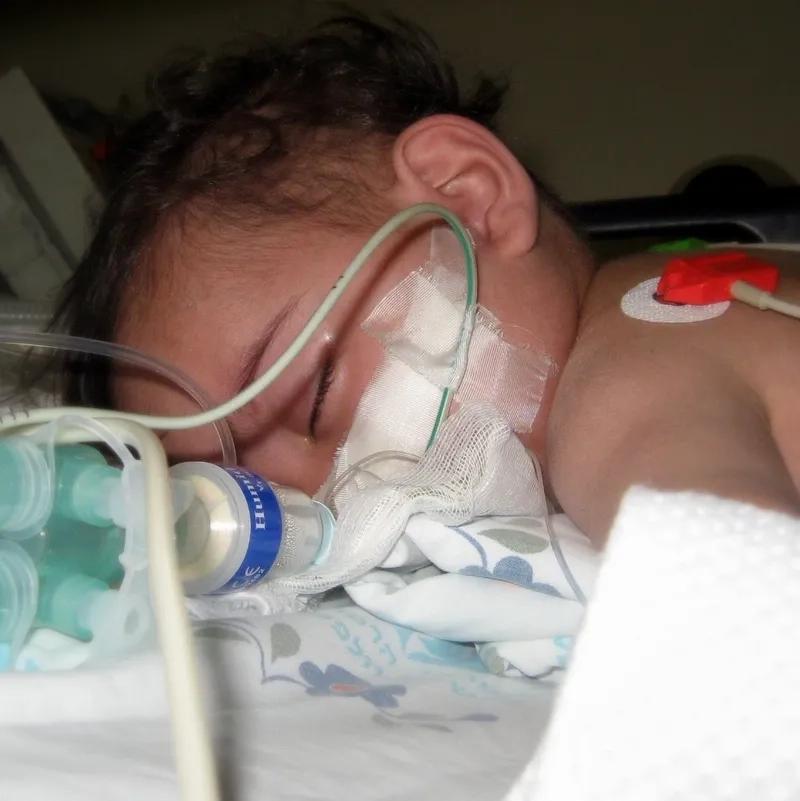 A guide to pneumococcal disease symptoms