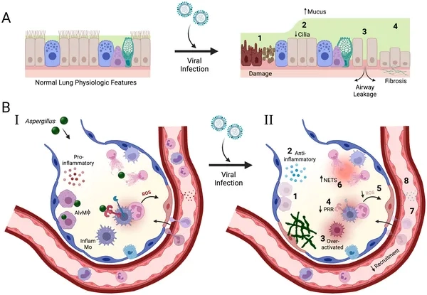 Illustration showing how pneumonia is contagious