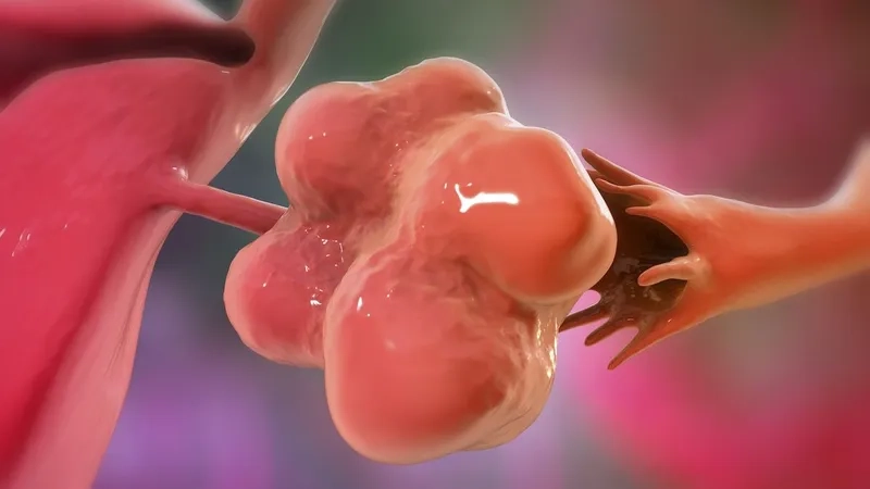 Calendar marking irregular periods