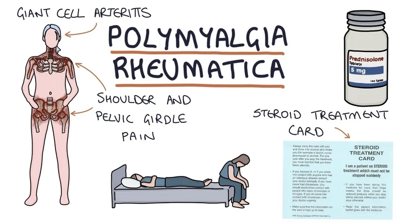 A chart showing common polymyalgia rheumatica symptoms
