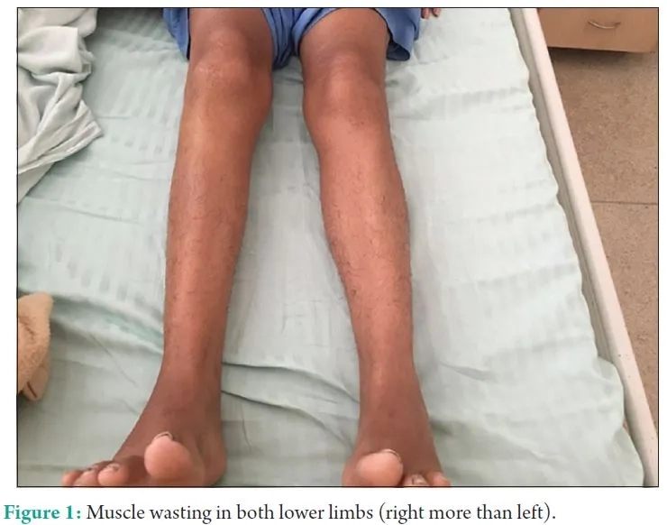 A medical slide defining an autoimmune muscle disease