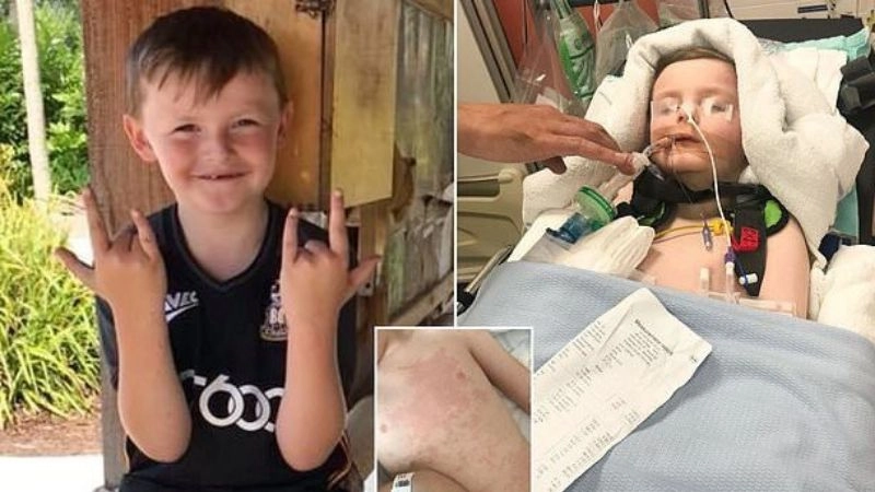 Accurate steps in pompe disease diagnosis