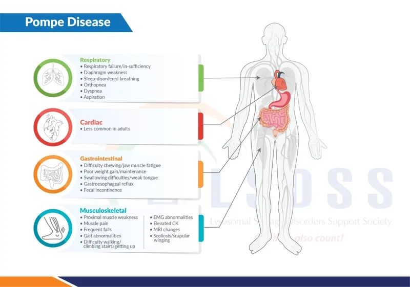 Available treatment options for Pompe disease