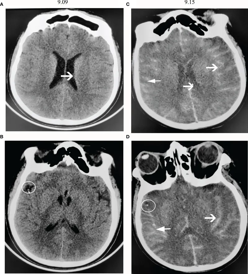 Graph showing the brain-eating amoeba survival rate