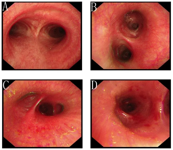The transmission cycle of psittacosis to humans