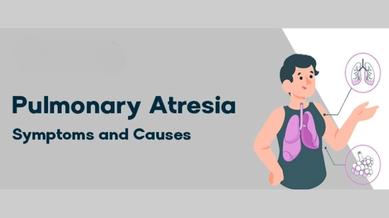 Pulmonary atresia symptoms signs parents should know