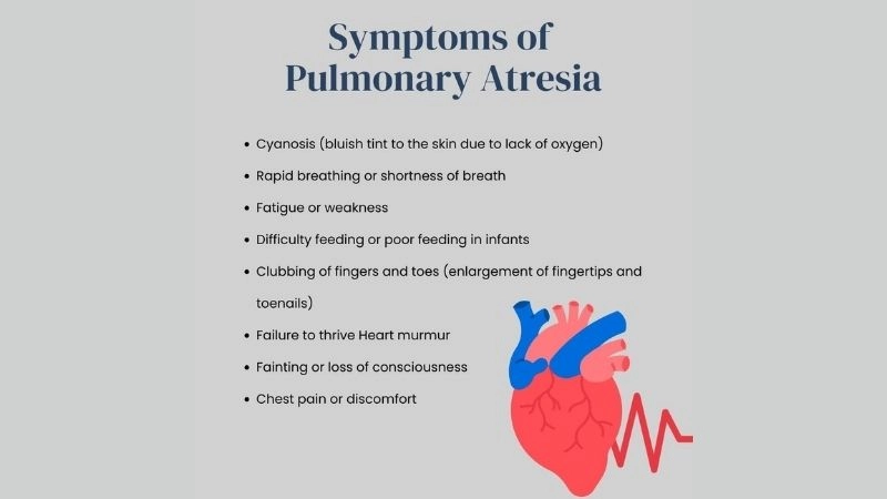 Pulmonary atresia intact ventricular septum condition overview