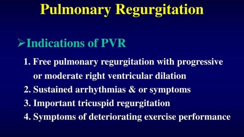 Pulmonary valve regurgitation explained simply