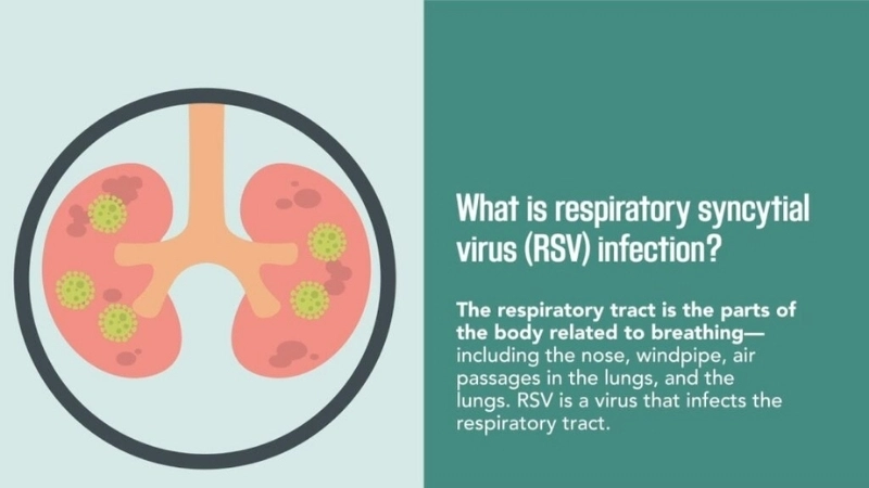 Learn effective RSV treatment options today