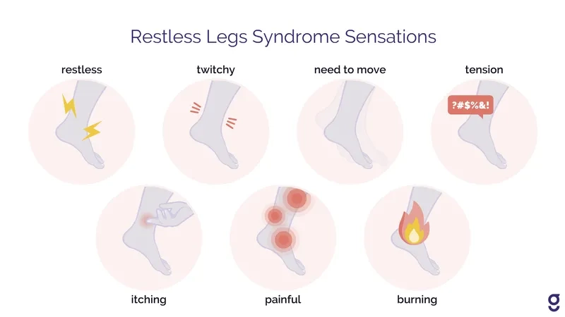 An infographic showing common restless legs syndrome symptoms